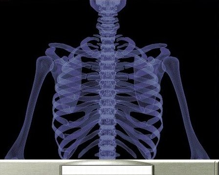 рентген человека